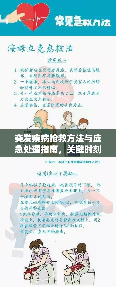 突发疾病抢救方法与应急处理指南，关键时刻救命必备！